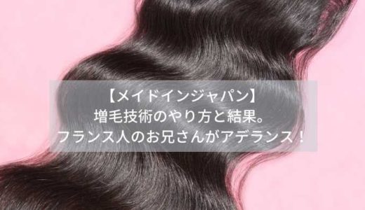 【メイドインジャパン】-増毛技術のやり方と結果。-フランス人のお兄さんがアデランス！
